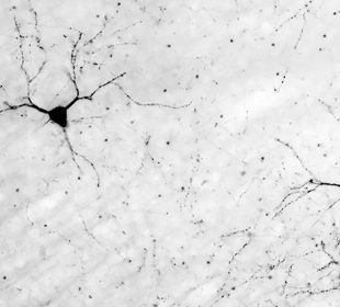 A black and white image of brainwaves