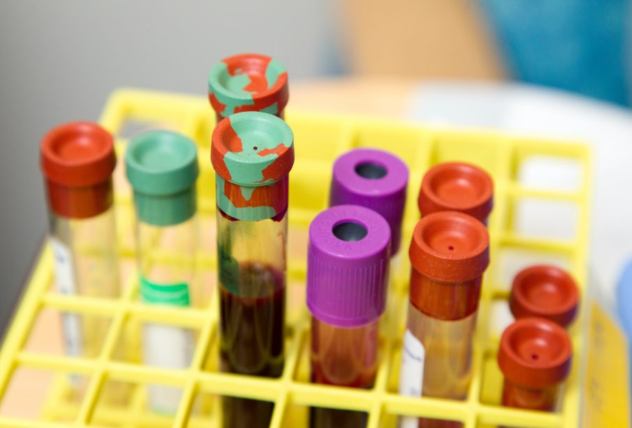 10 vials of blood in a yellow tray