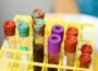 10 vials of blood in a yellow tray