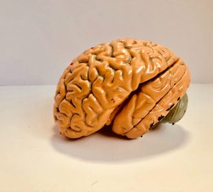 An orange, plastic, realistic model of the human brain placed upon a white surface